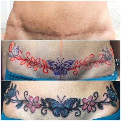 best tummy tuck cover up tattoos|Top 26 Best tummy tuck scar cover up tattoos – Tattoo Shops